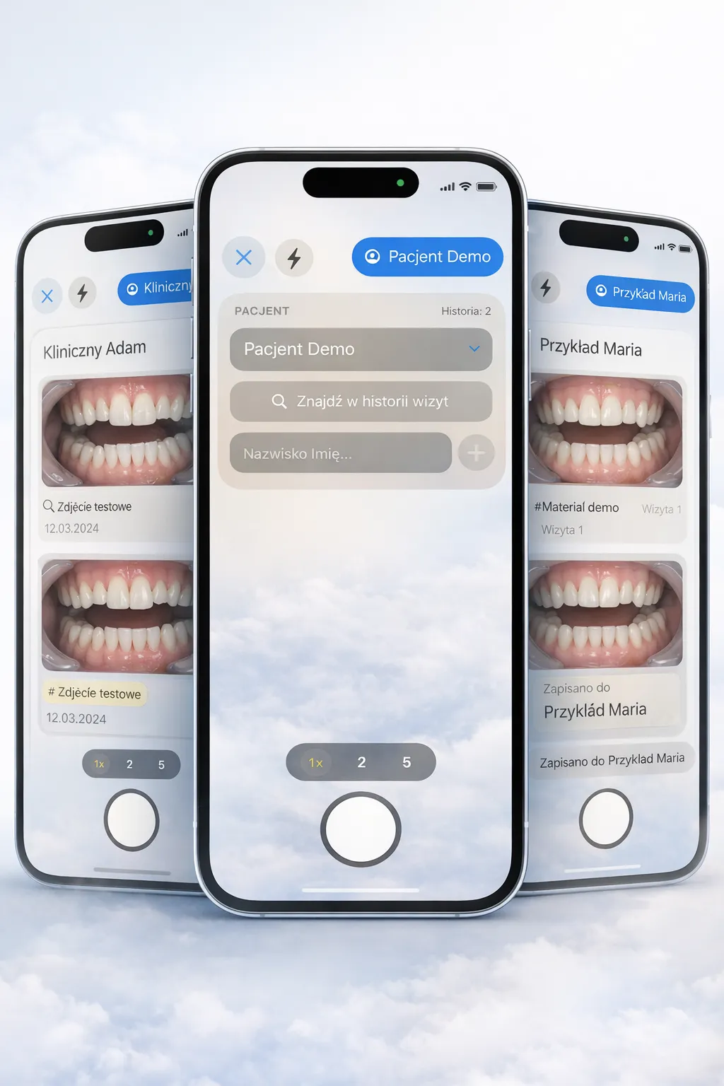 SnapSort na trzech iPhone'ach: aparat, pacjenci i przegląd wizyty