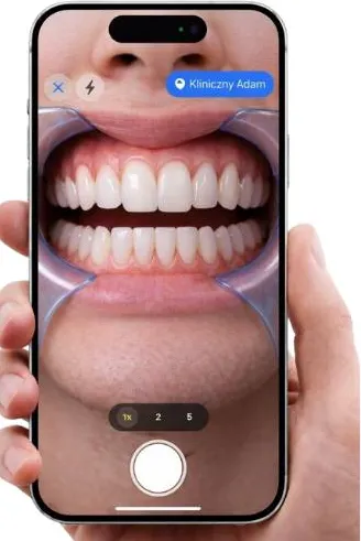 iPhone w dłoni robiący zdjęcie uzębienia pacjenta w aplikacji SnapSort