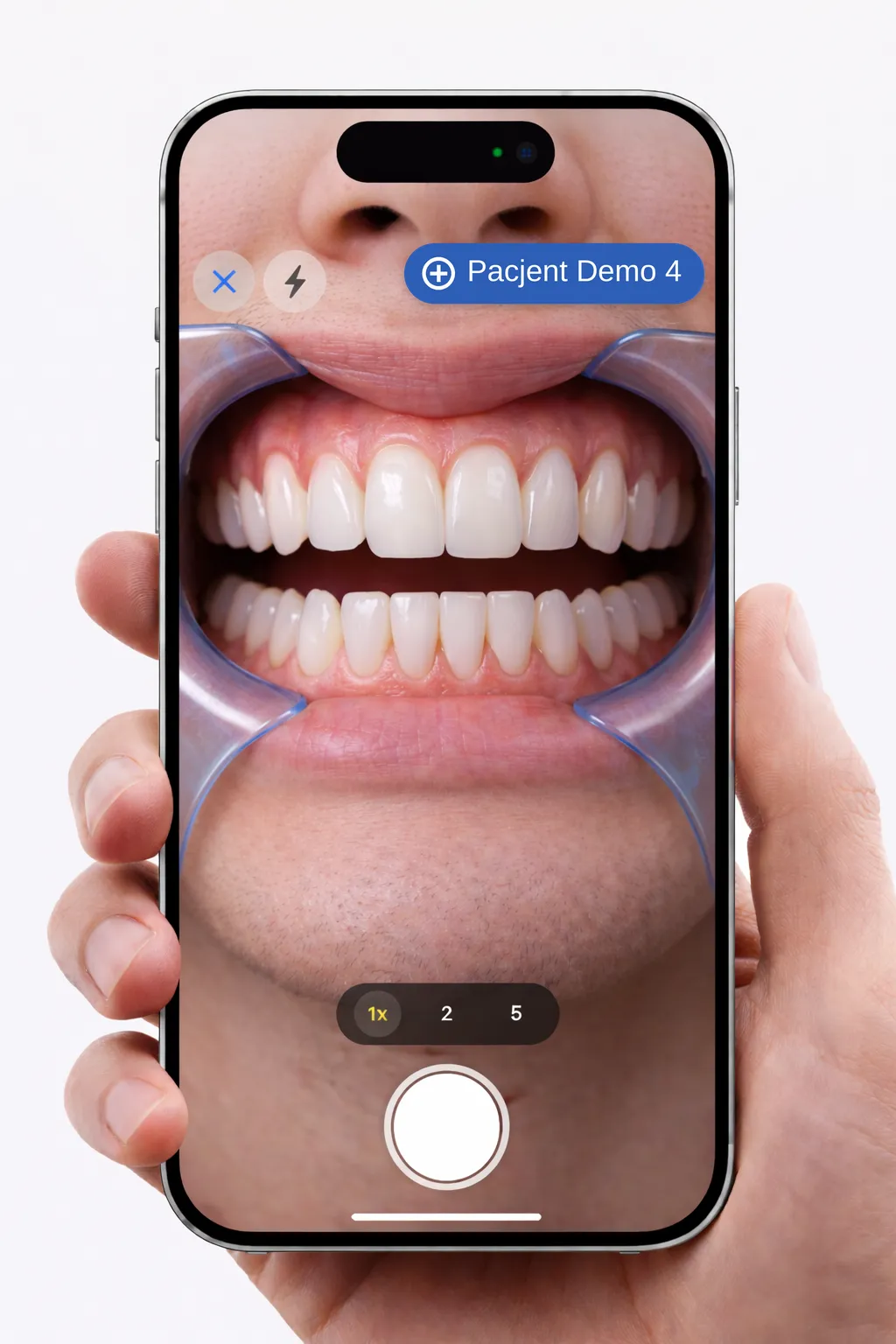 iPhone w dłoni robiący zdjęcie uzębienia pacjenta w aplikacji SnapSort